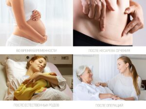 Прокладки Roxy Kids послеродовые EXTRA с бортиками и крылышками 32см, 10шт. 18